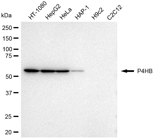 Protein Disulfide Isomerase/P4HB Antibody (24GB2780)