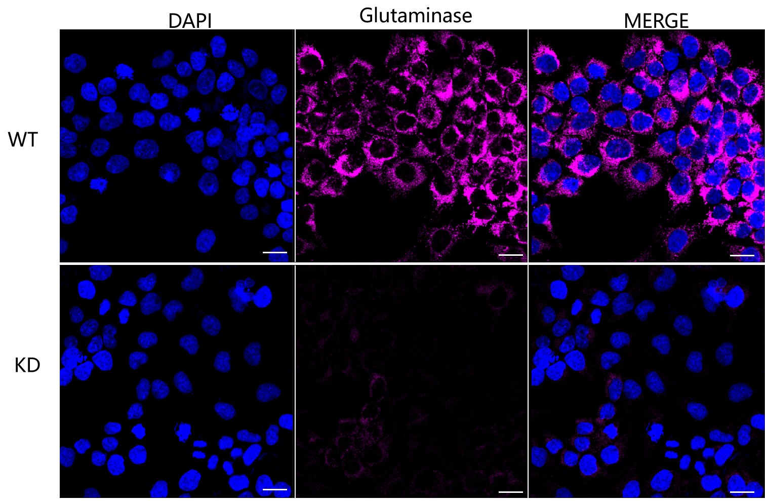 Glutaminase Antibody (23GB1720)