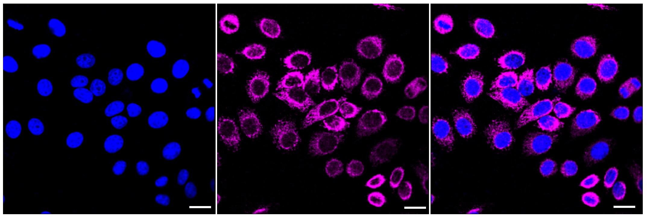 Glutaminase Antibody (23GB1720)