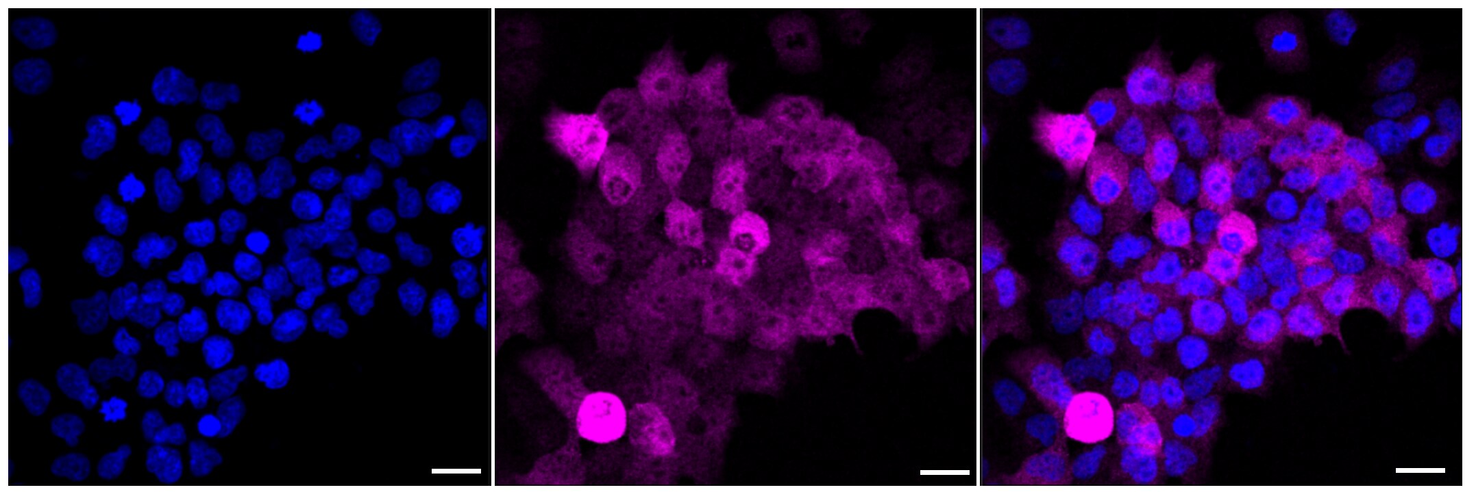 Glutamine Synthetase Antibody (23GB1345)