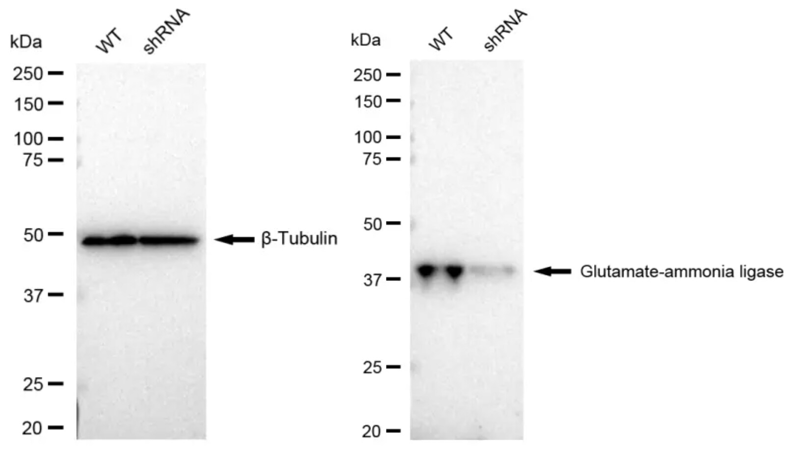Glutamine Synthetase Antibody (23GB1345)