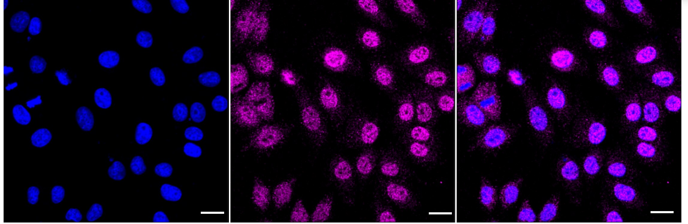 TOR/mTOR Antibody (24GB3755)
