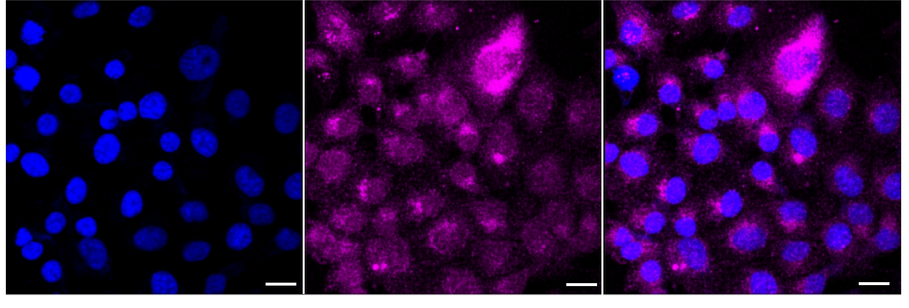 Serpin E1/PAI-1 Antibody (24GB4055)