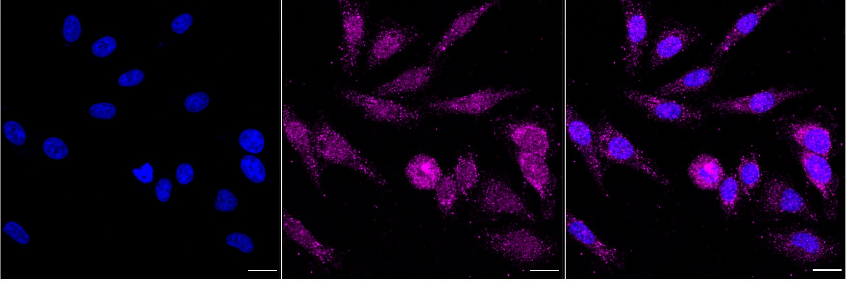 EMMPRIN/CD147 Antibody (24GB4260)