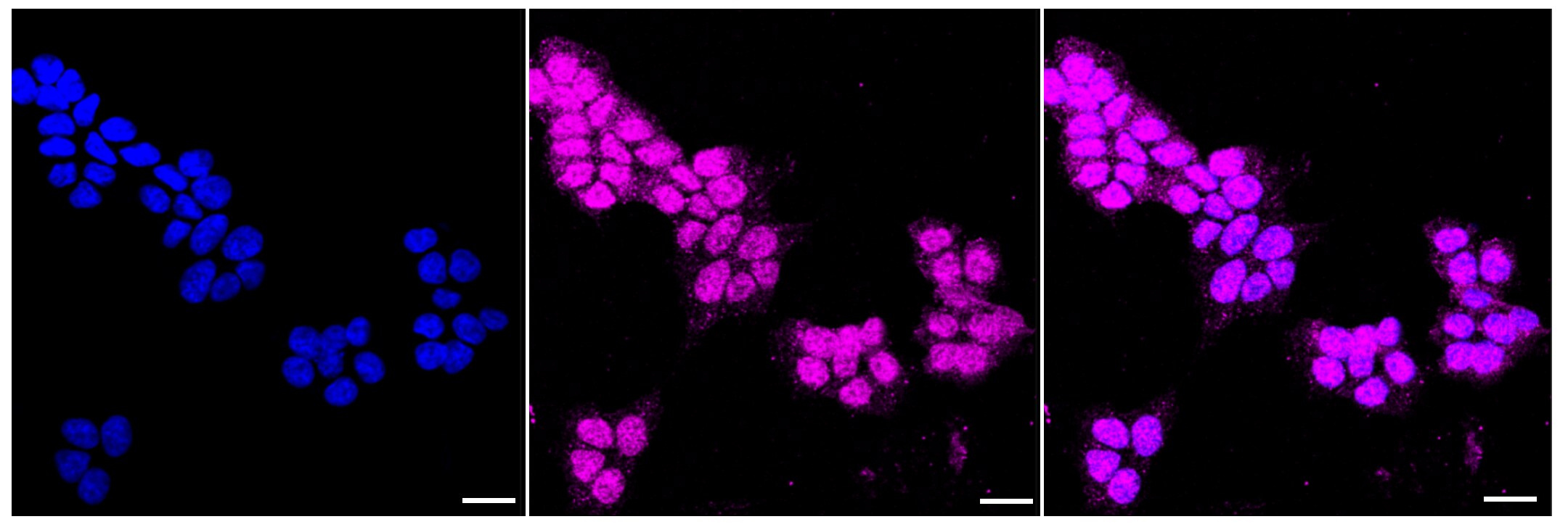 GAP-43 Antibody (23GB1195)