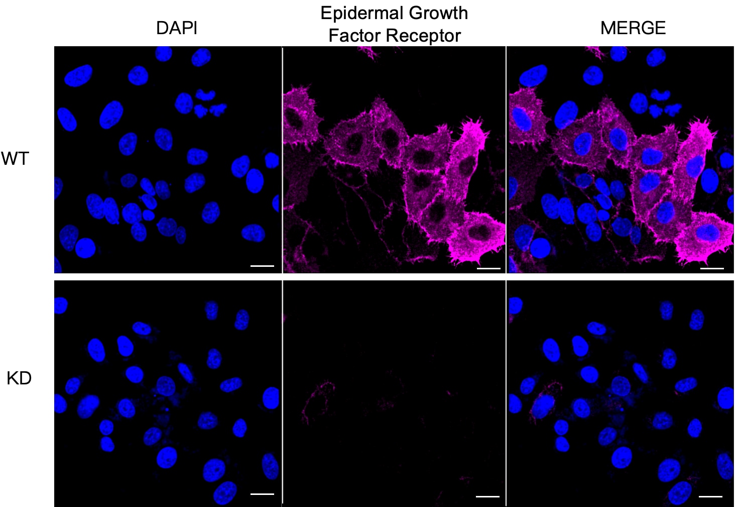 EGFR Antibody (24GB4395)