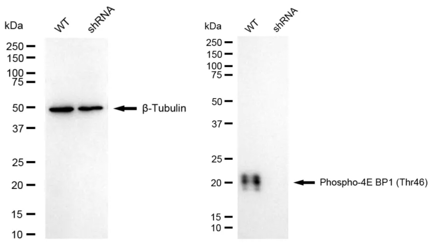 4EBP1 [p Thr46] Antibody (24GB4405)
