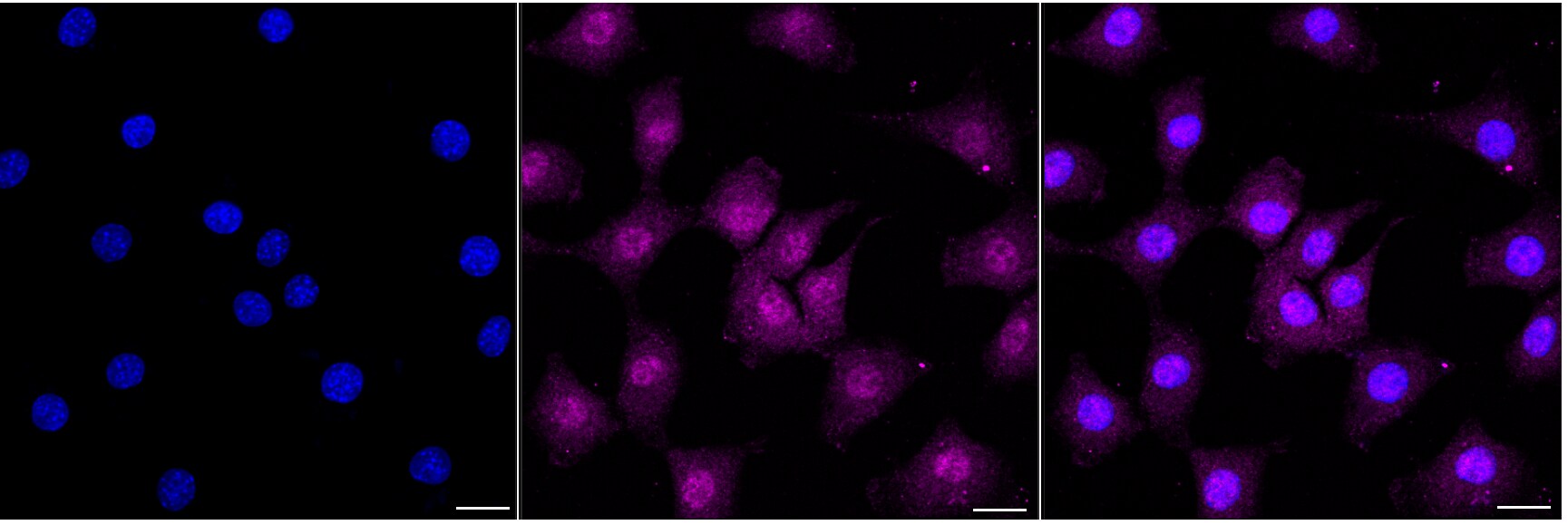 4EBP1 Antibody (24GB4410)