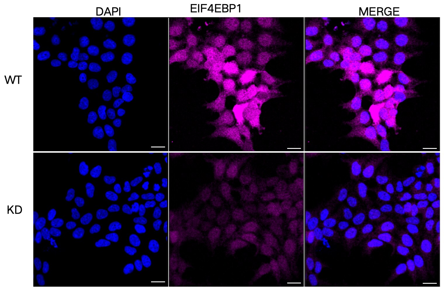 4EBP1 Antibody (24GB4410)