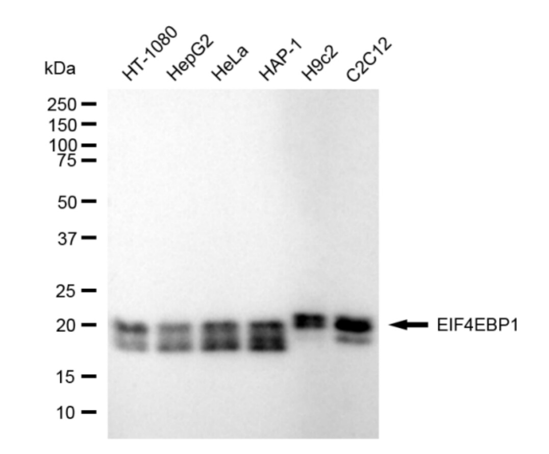4EBP1 Antibody (24GB4410)