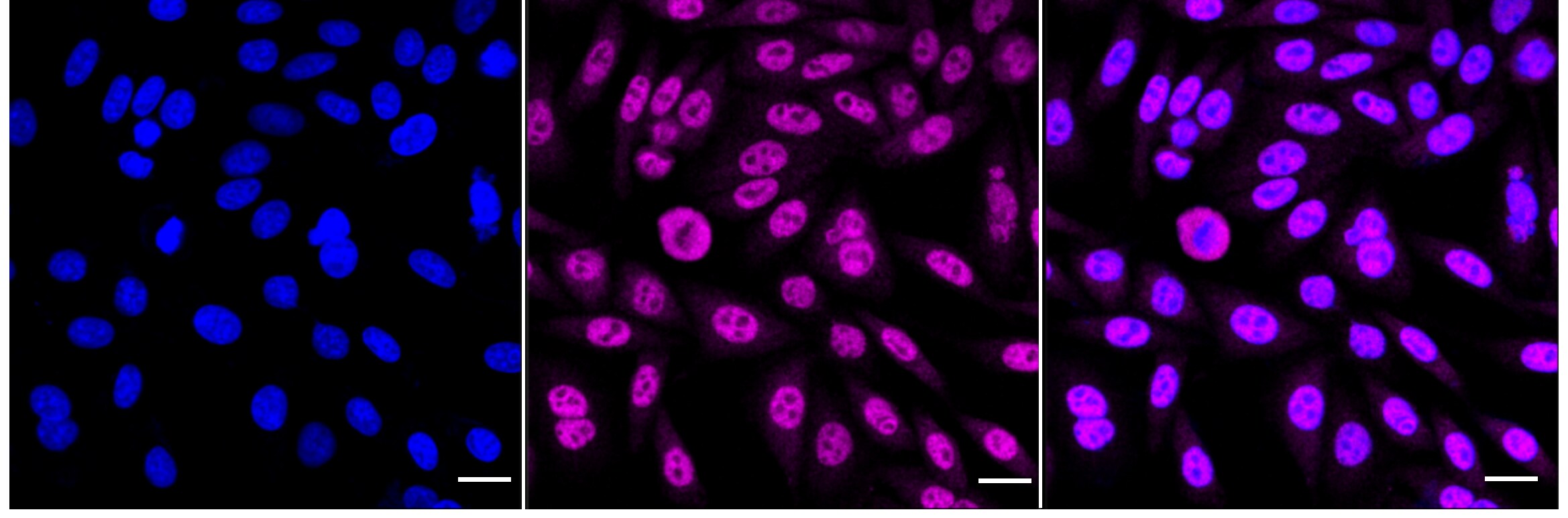 PKC alpha [p Thr638] Antibody (24GB4470)