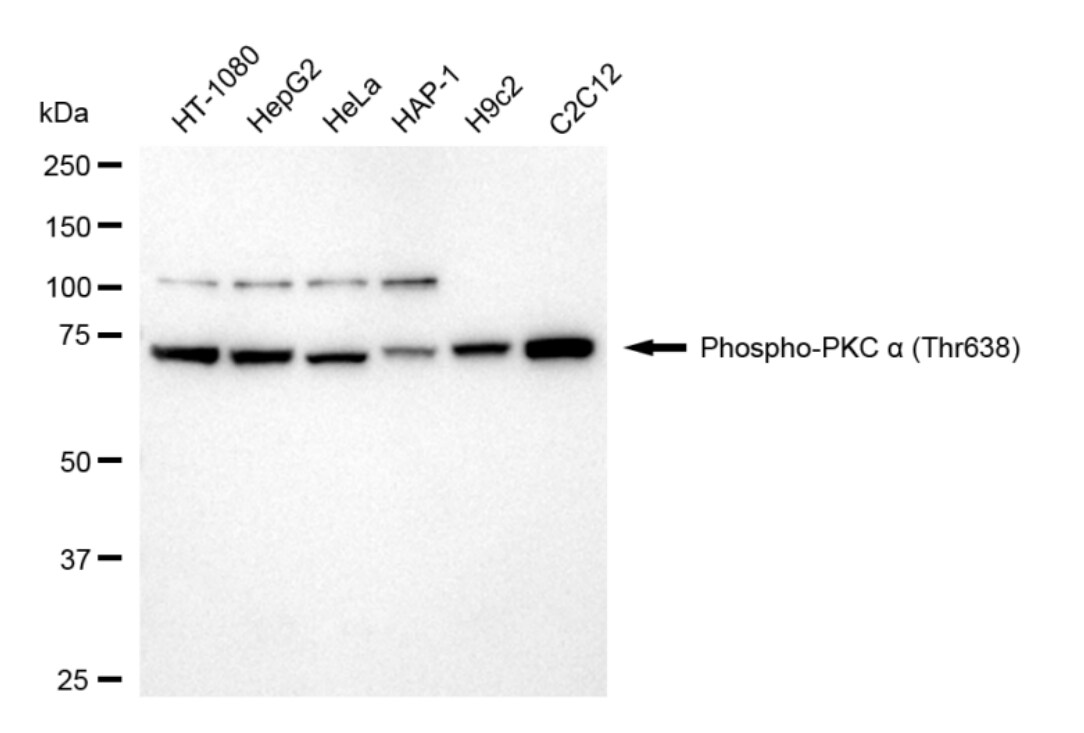 PKC alpha [p Thr638] Antibody (24GB4470)