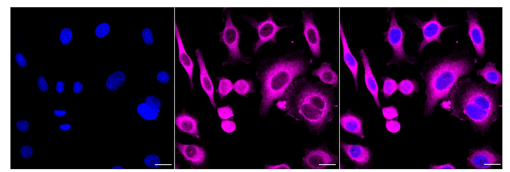 PKC alpha Antibody (24GB4475)
