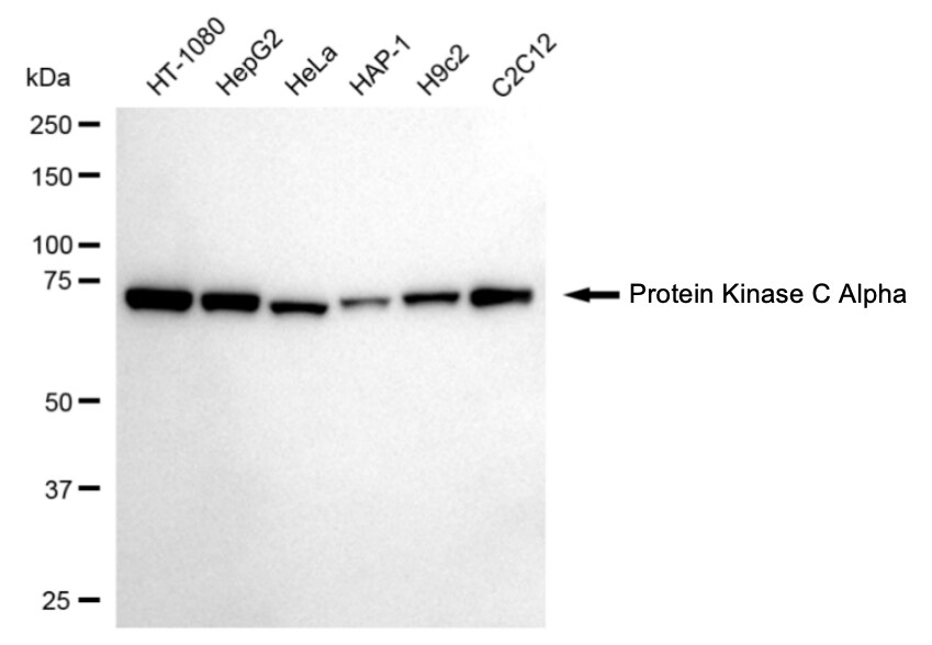 PKC alpha Antibody (24GB4475)