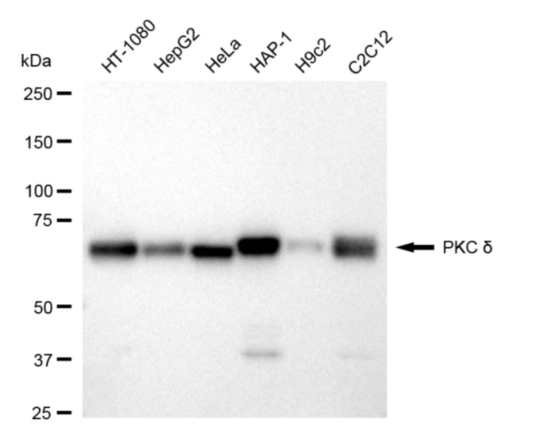 PKC delta Antibody (24GB4485)