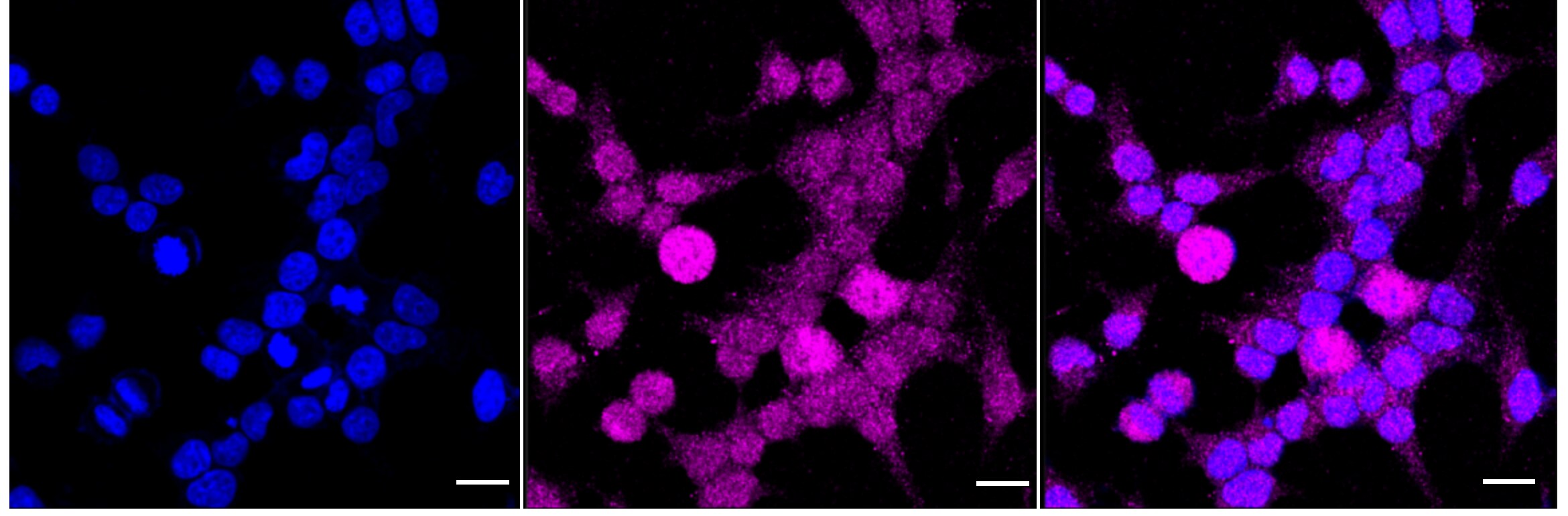 Presenilin-1 [p Ser310] Antibody (24GB4510)