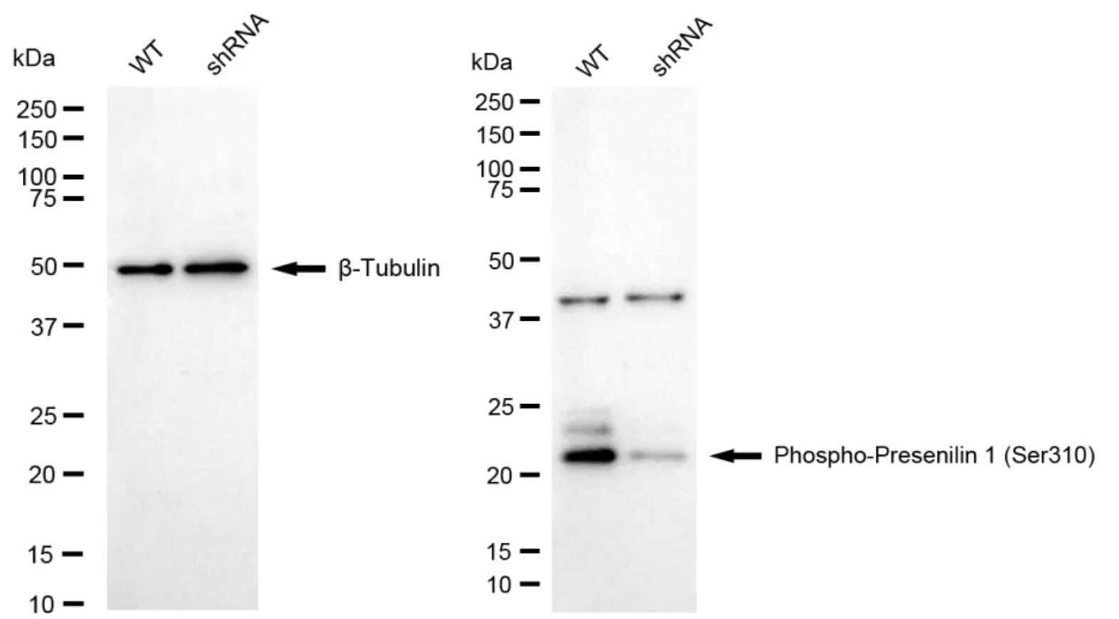 Presenilin-1 [p Ser310] Antibody (24GB4510)
