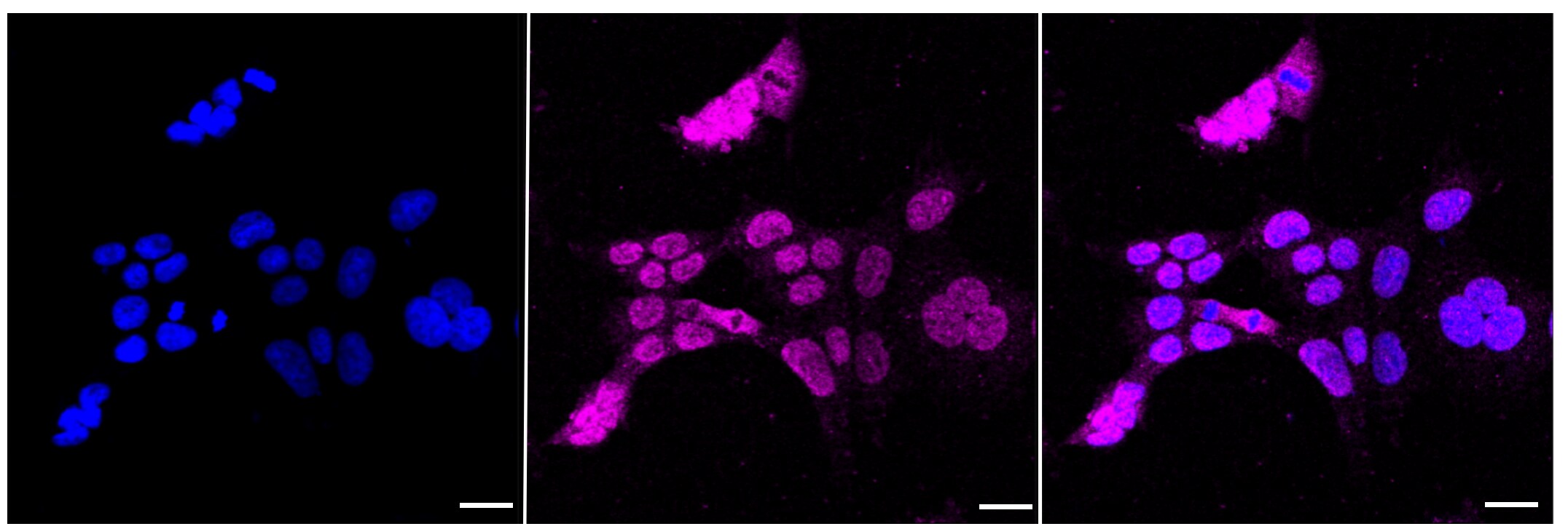 IRAK3 Antibody (23GB875)