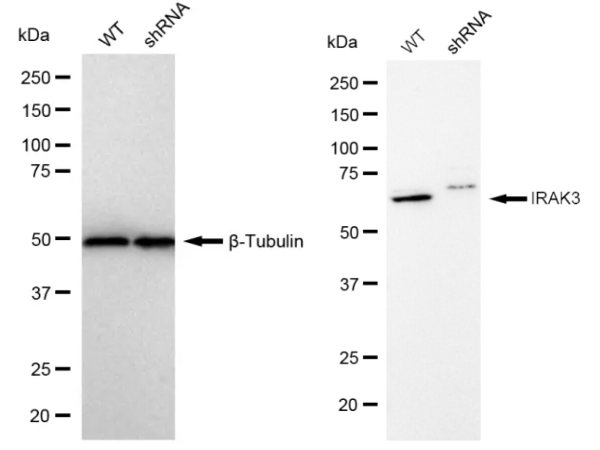 IRAK3 Antibody (23GB875)