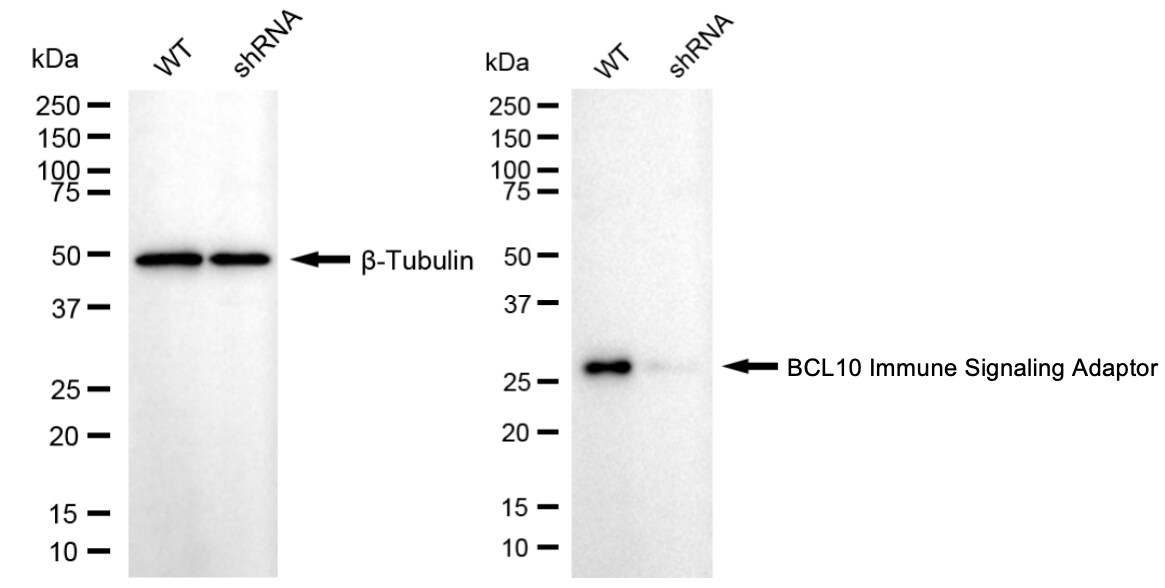 Bcl-10 Antibody (24GB4560)