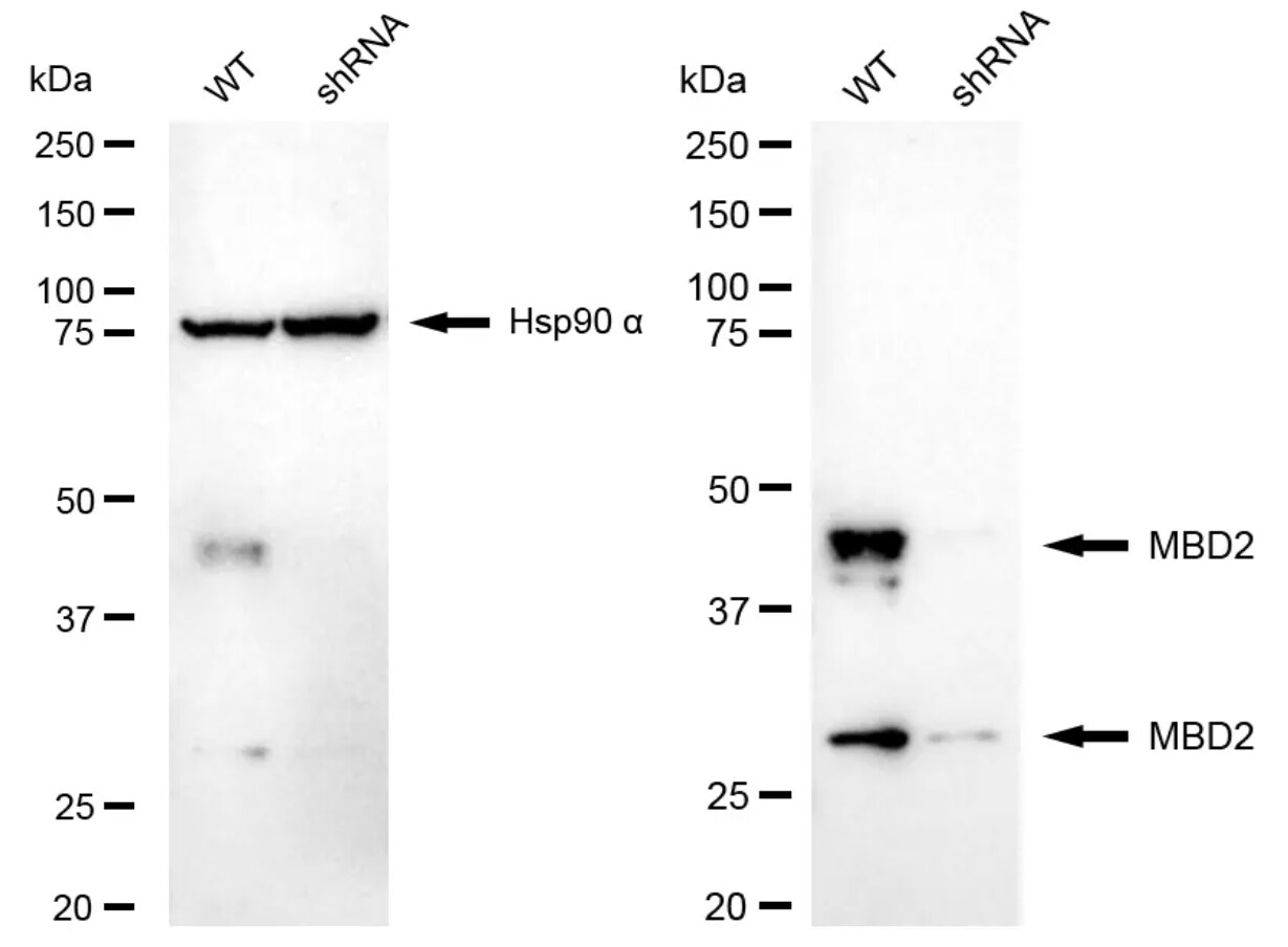 MBD2 Antibody (24GB4570)