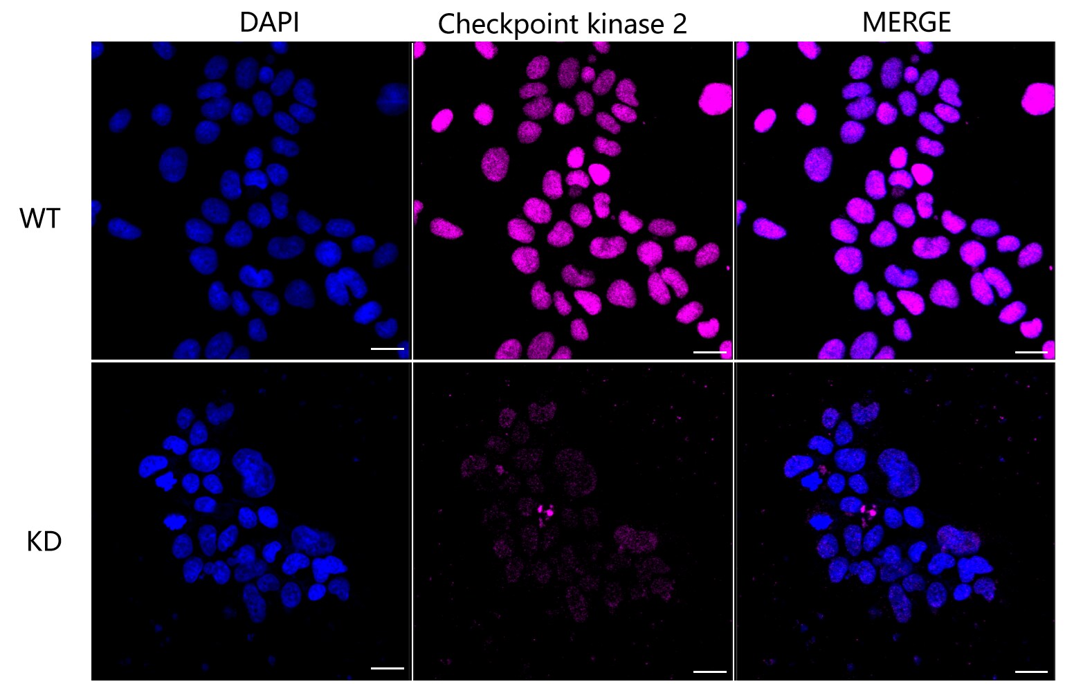 Chk2 Antibody (24GB4585)