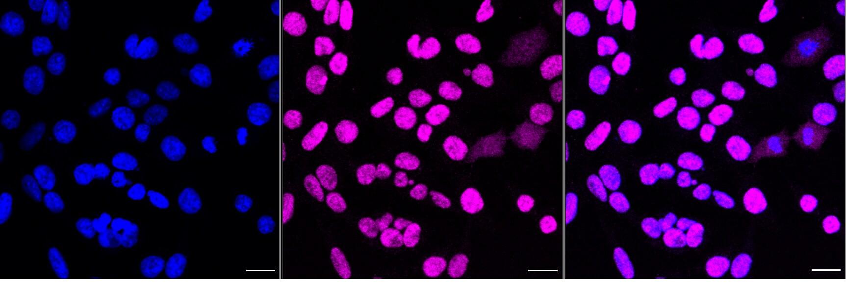 Chk2 Antibody (24GB4585)