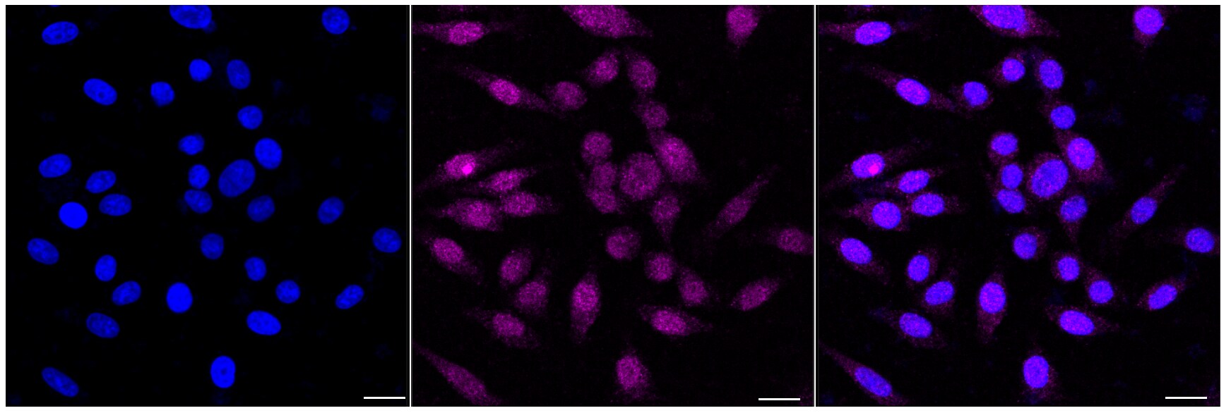 MLKL Antibody (24GB4615)