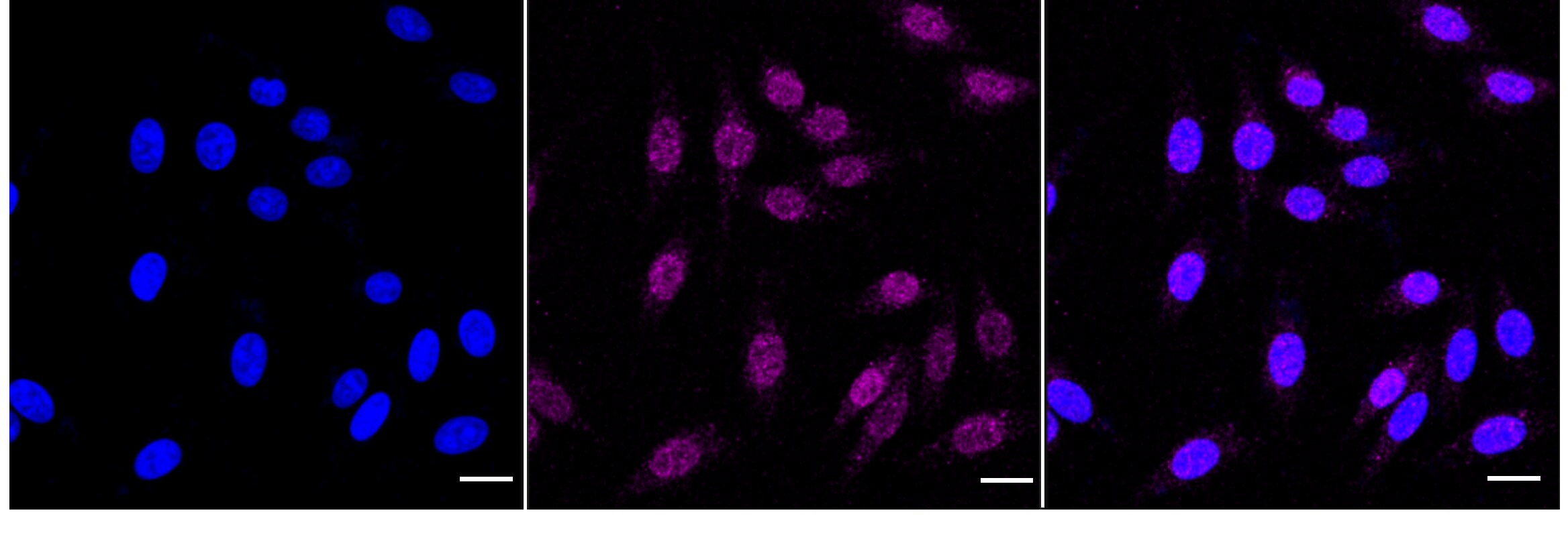 MLKL Antibody (24GB4620)