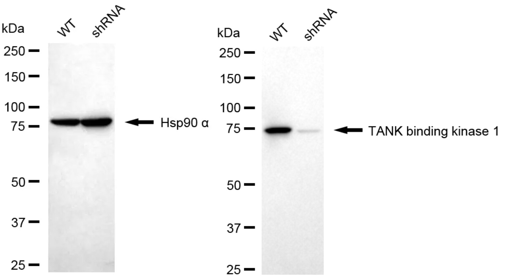 TBK1 Antibody (24GB4645)