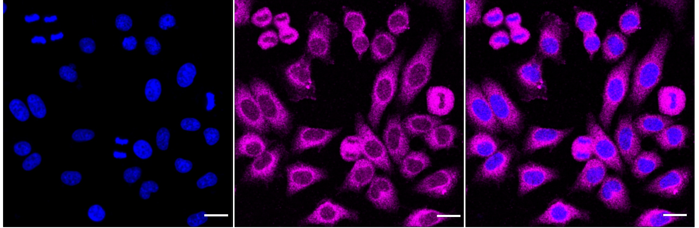 TBK1 Antibody (24GB4650)