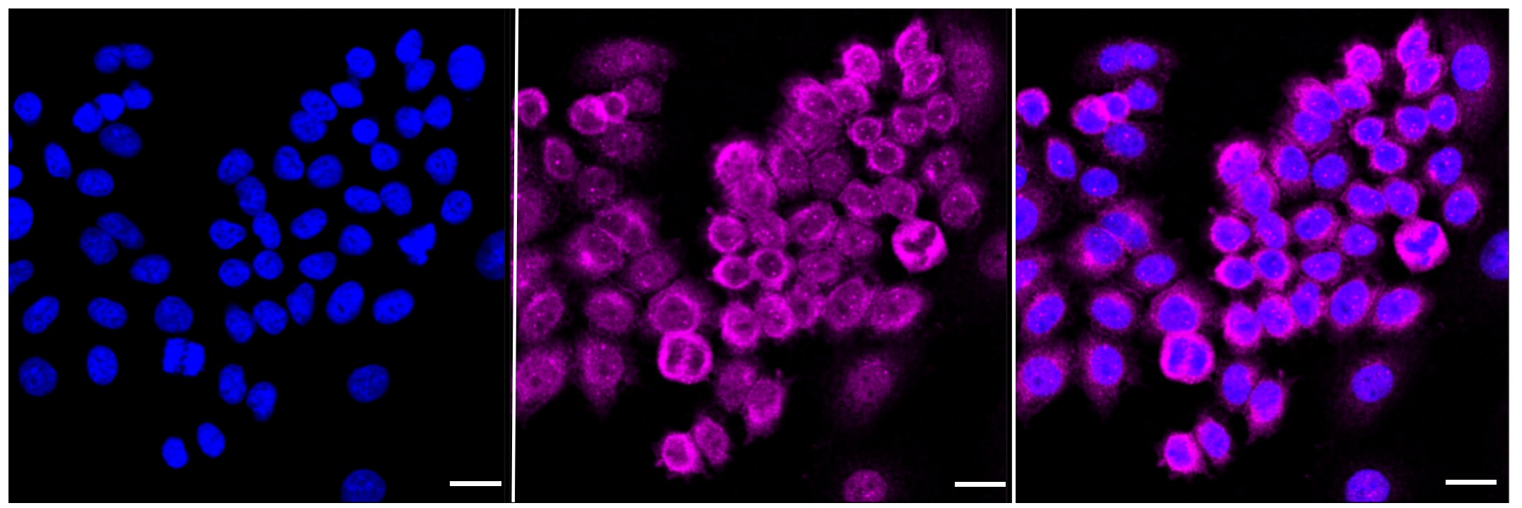 RelA/NFkB p65 Antibody (23GB1490)