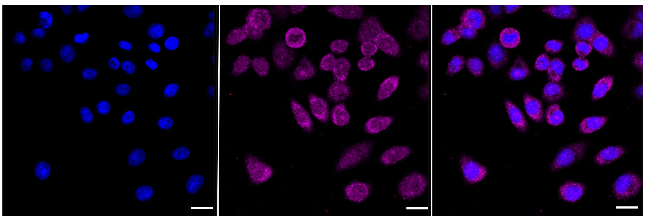 HDAC3 Antibody (23GB860)