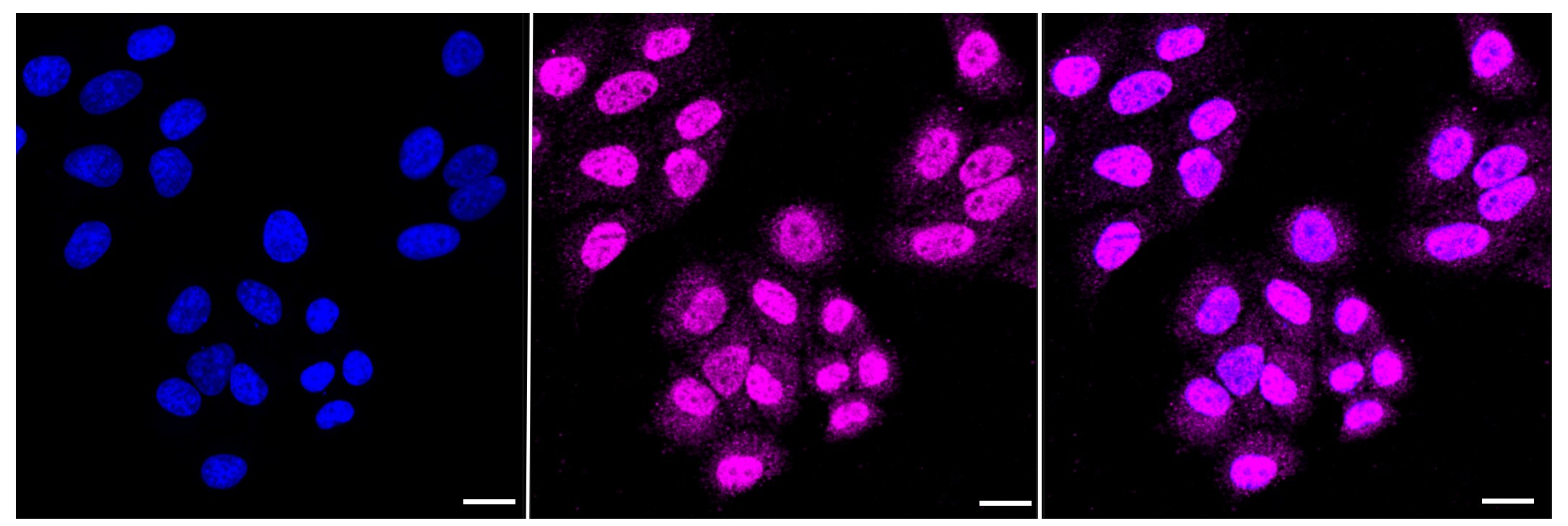 Histone Deacetylase 4/HDAC4 Antibody (23GB865)