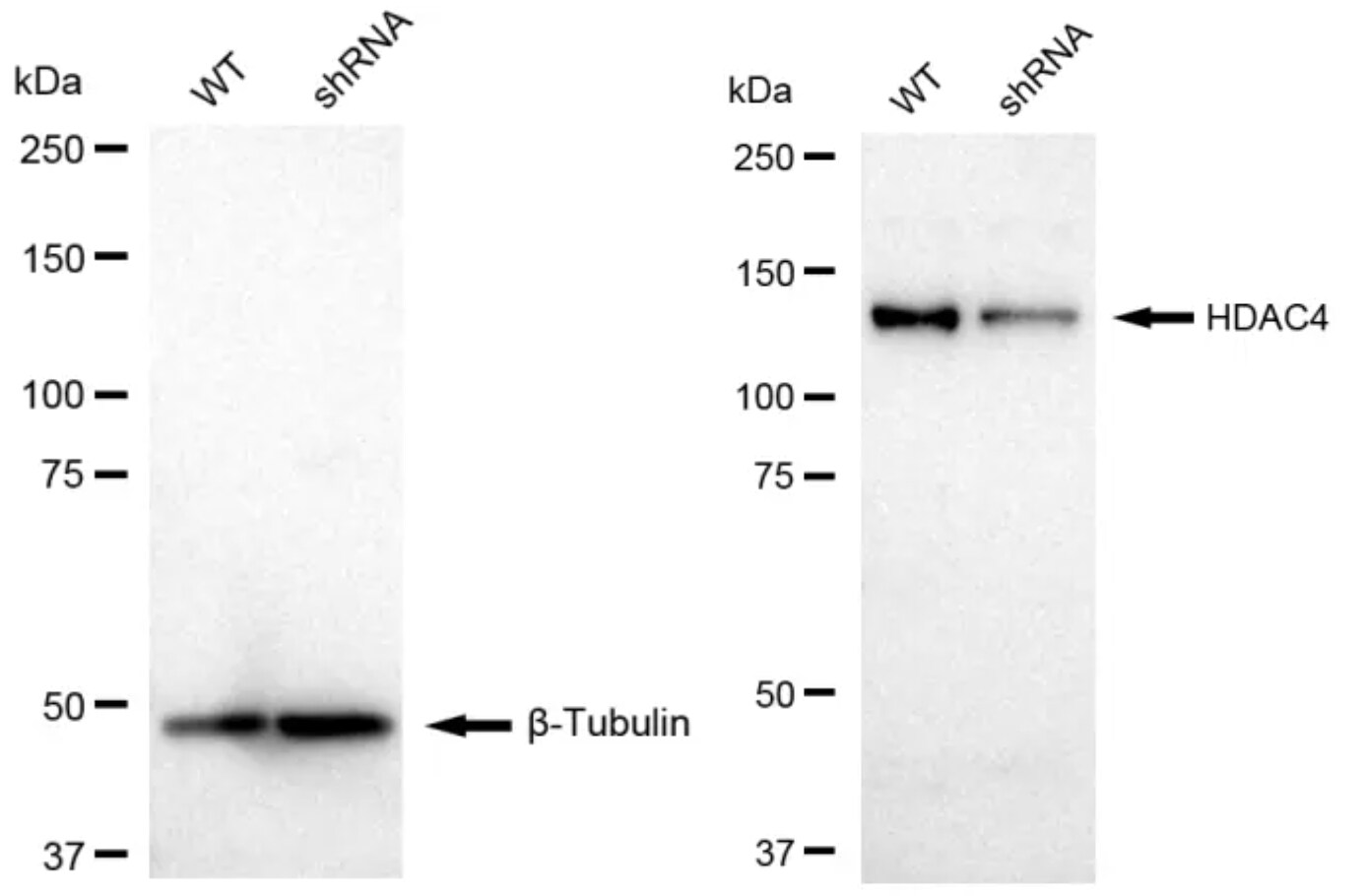 Histone Deacetylase 4/HDAC4 Antibody (23GB865)