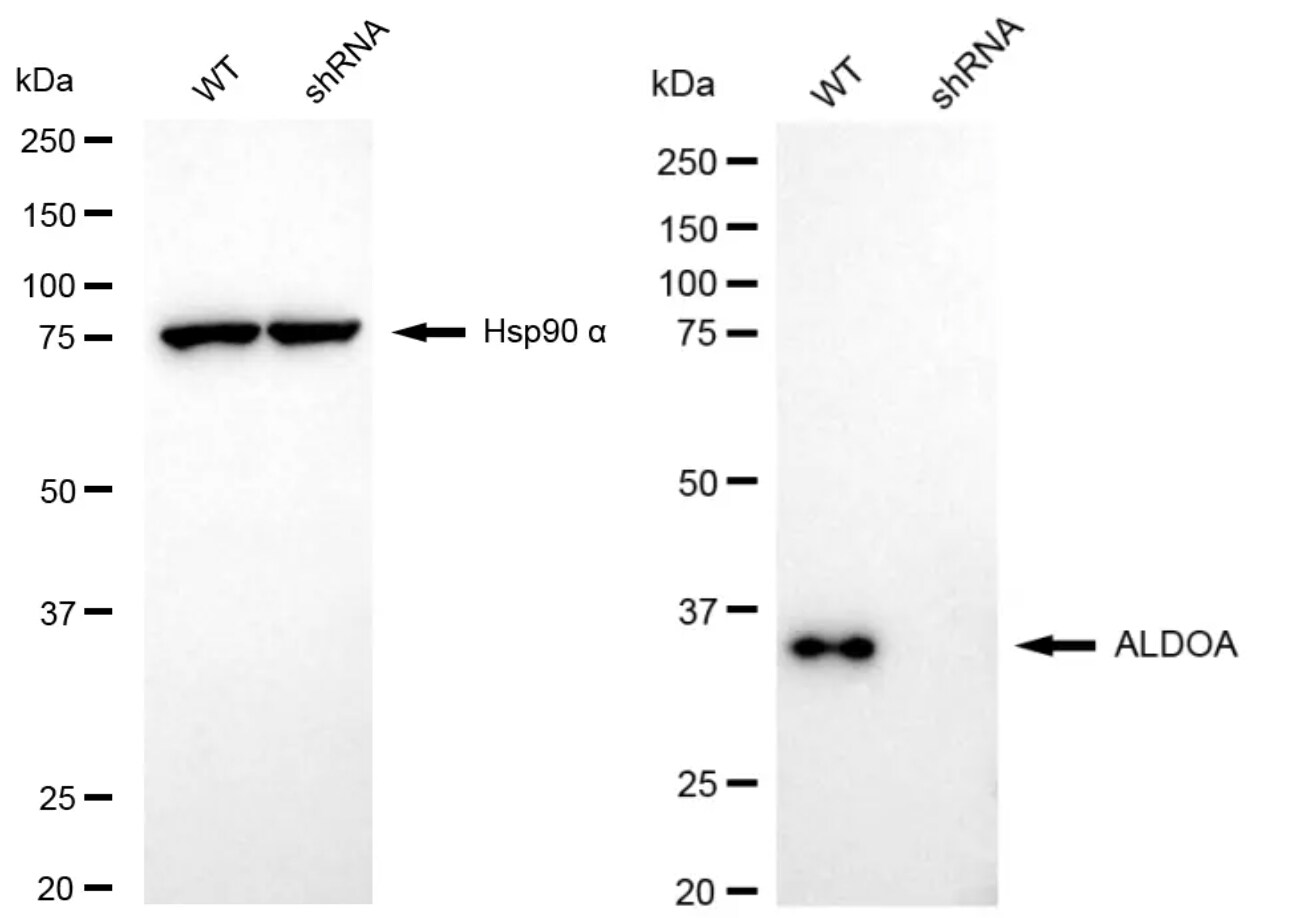 Aldolase A Antibody (24GB4710)
