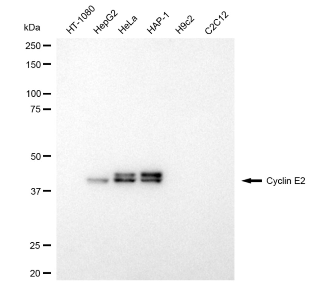 Cyclin E2 Antibody (24GB4750)