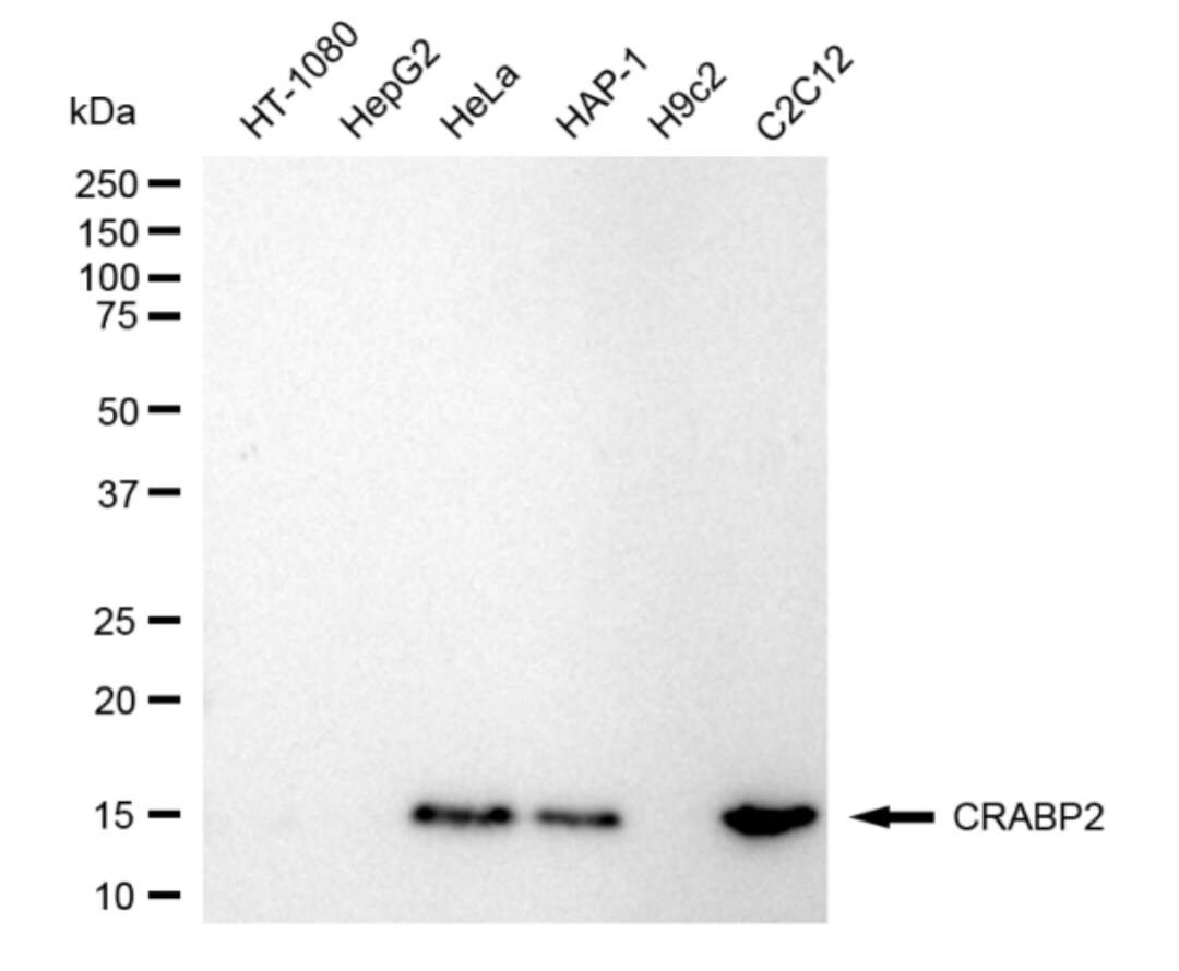 CRABP2 Antibody (24GB4790)