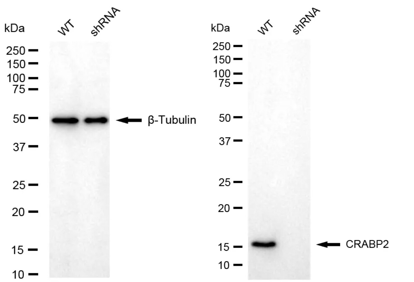 CRABP2 Antibody (24GB4790)