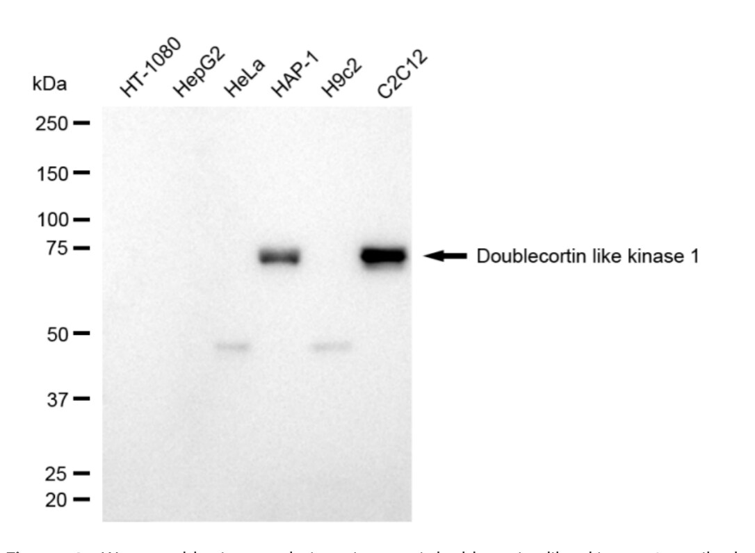 DCLK1 Antibody (24GB4805)