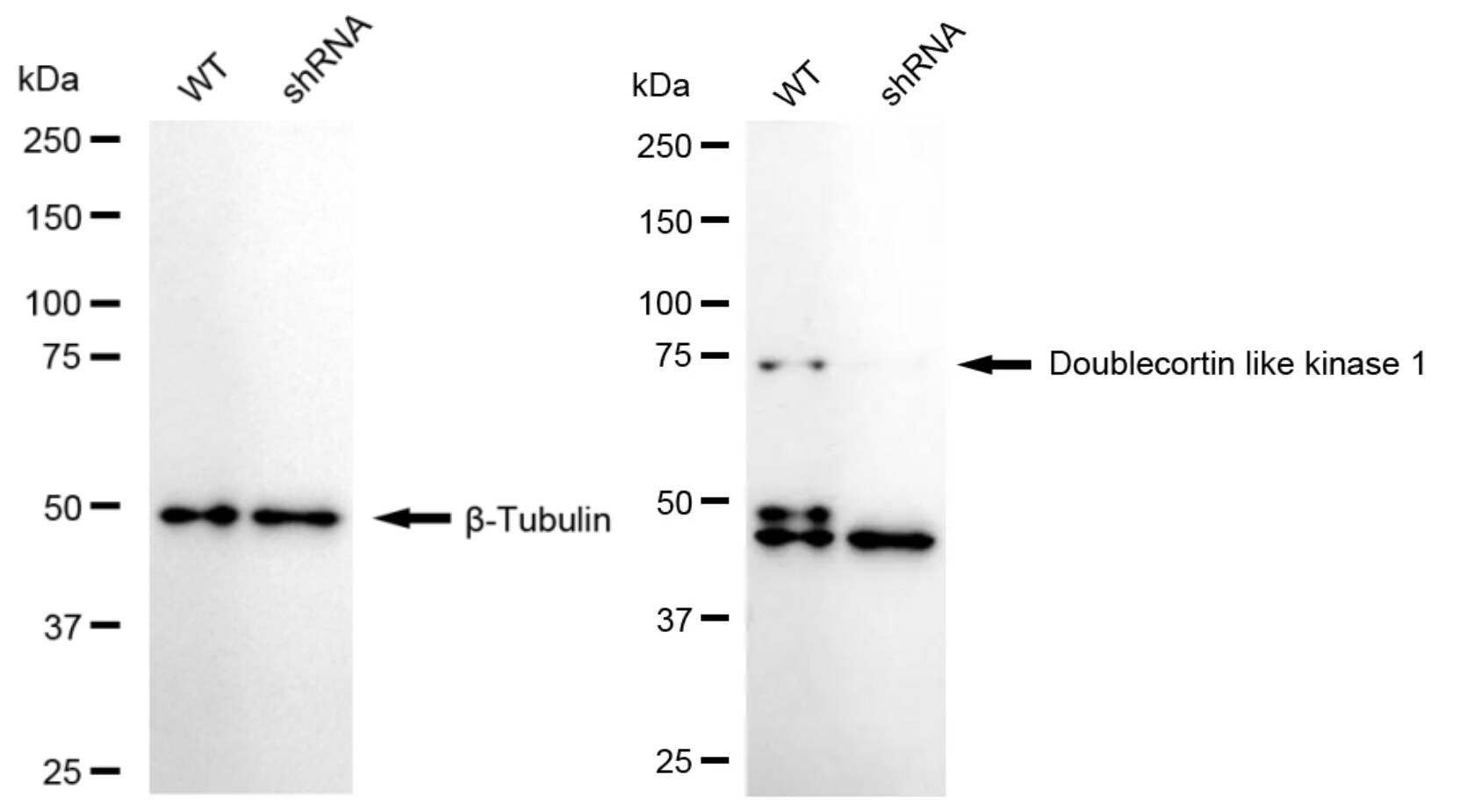 DCLK1 Antibody (24GB4805)
