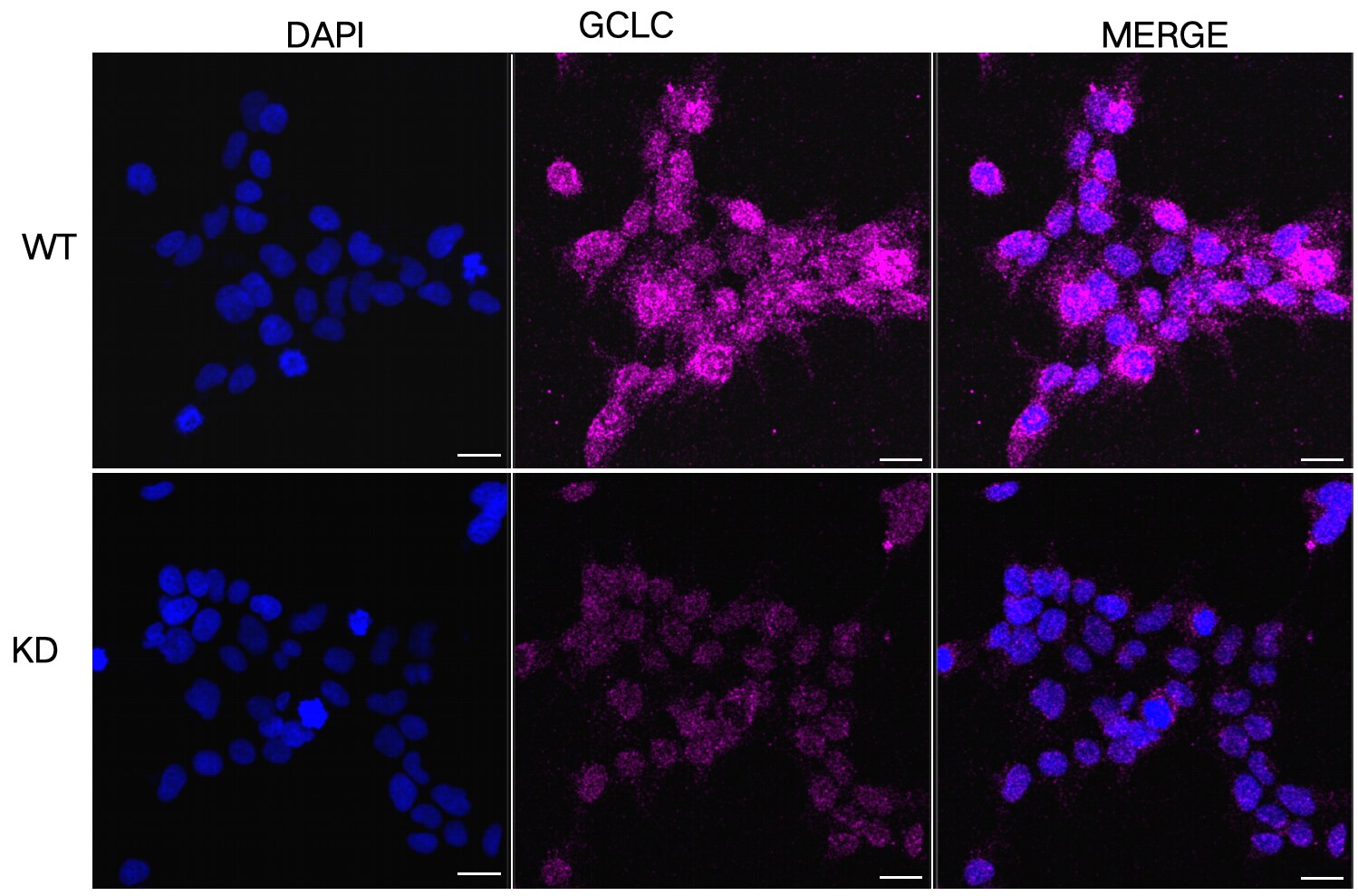 GCLC Antibody (24GB4860)