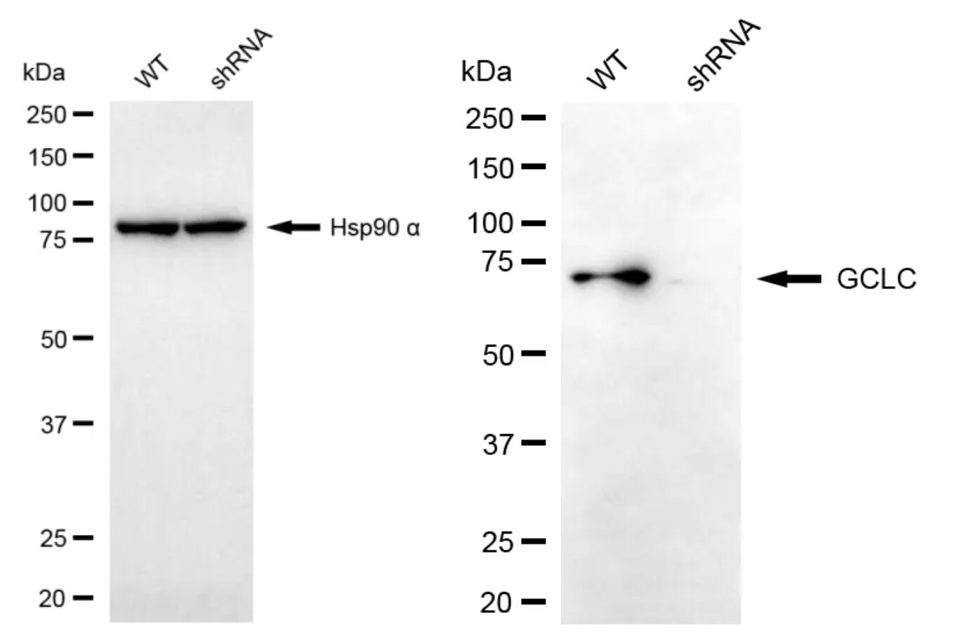 GCLC Antibody (24GB4860)