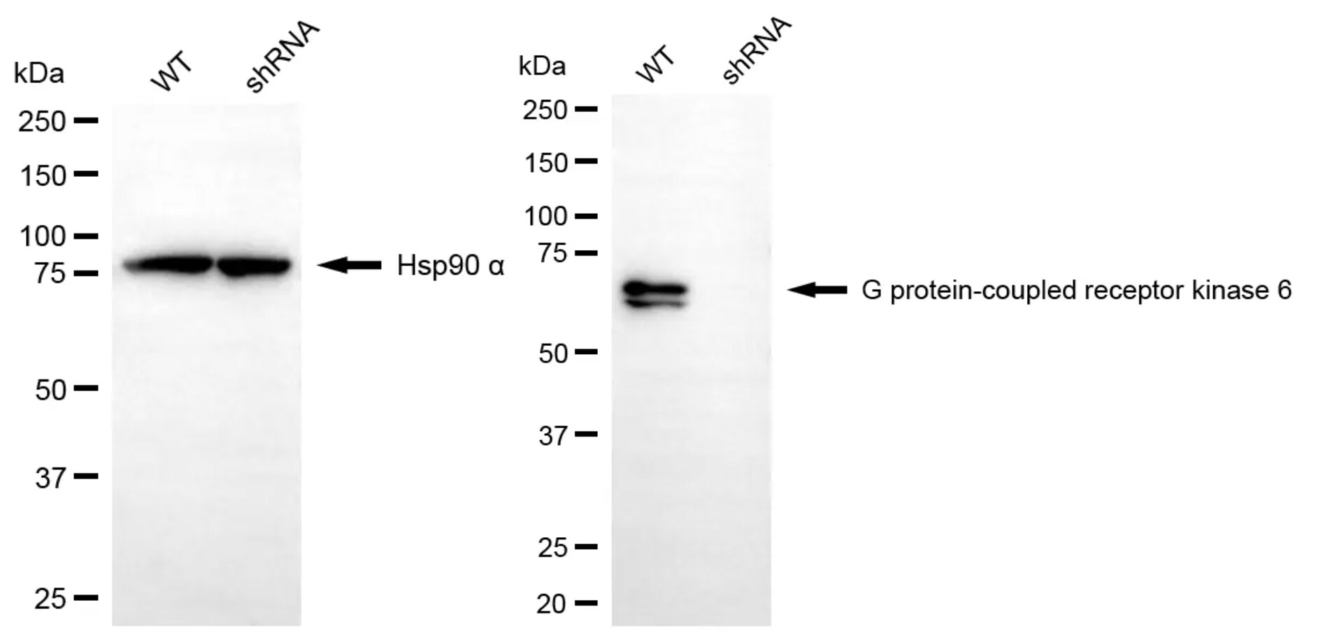 GRK6 Antibody (24GB4870)