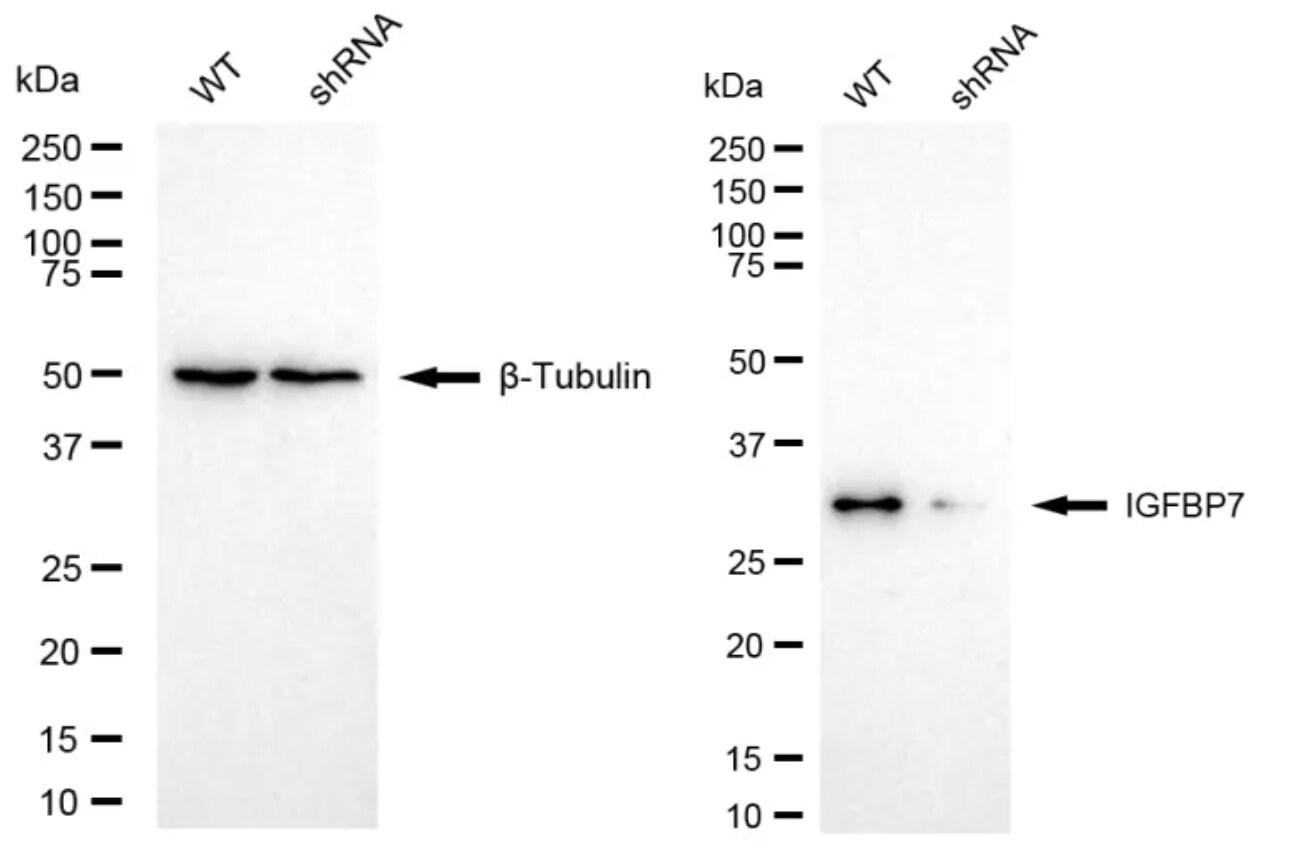 IGFBP-rp1/IGFBP-7 Antibody (24GB4910)