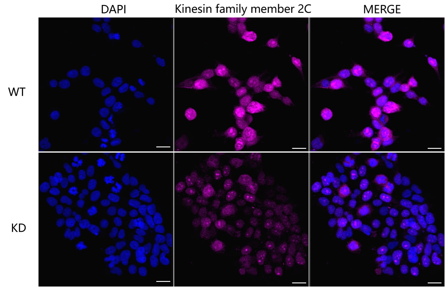 KIF2C Antibody (24GB4930)