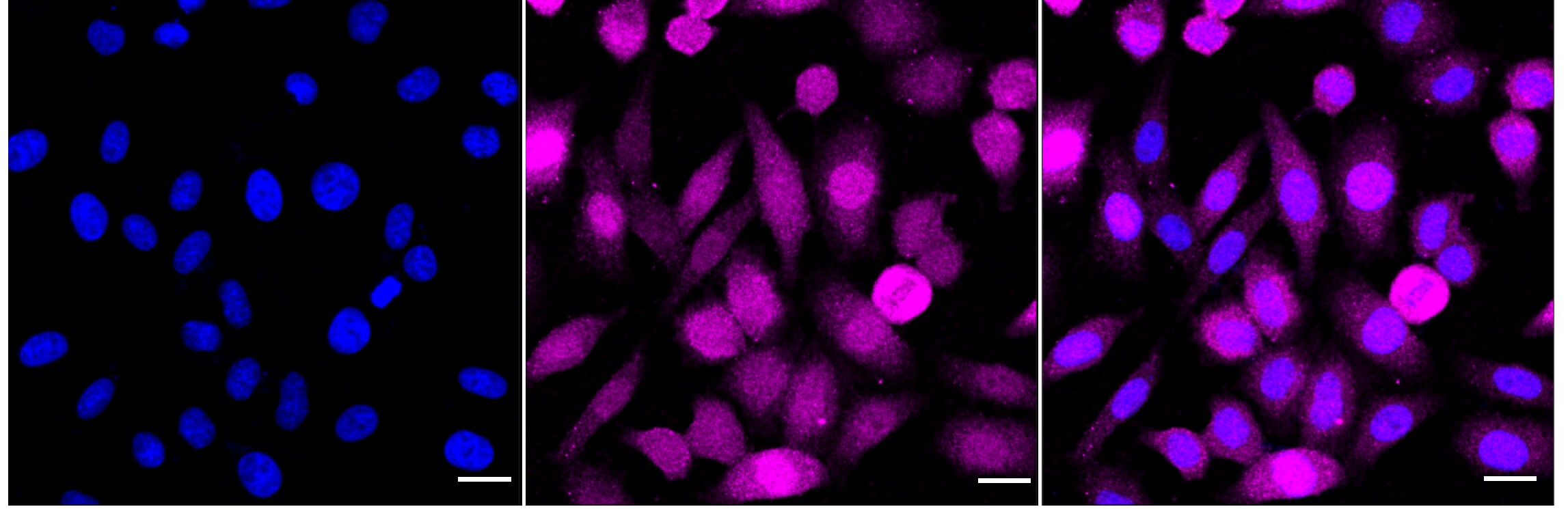 KIF2C Antibody (24GB4930)