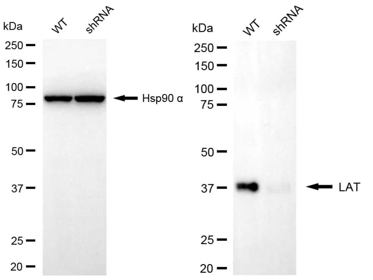 LAT Antibody (24GB4940)