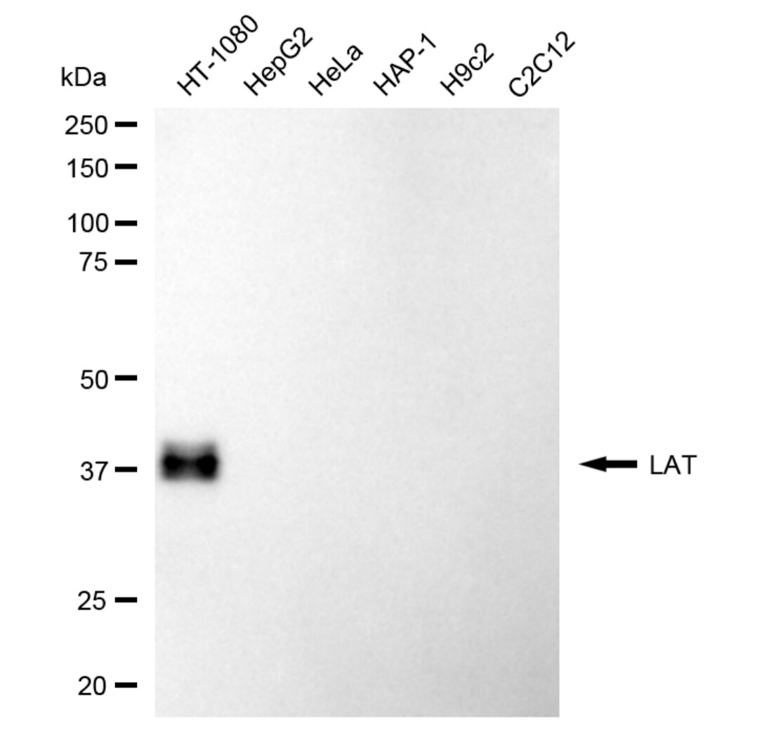 LAT Antibody (24GB4940)