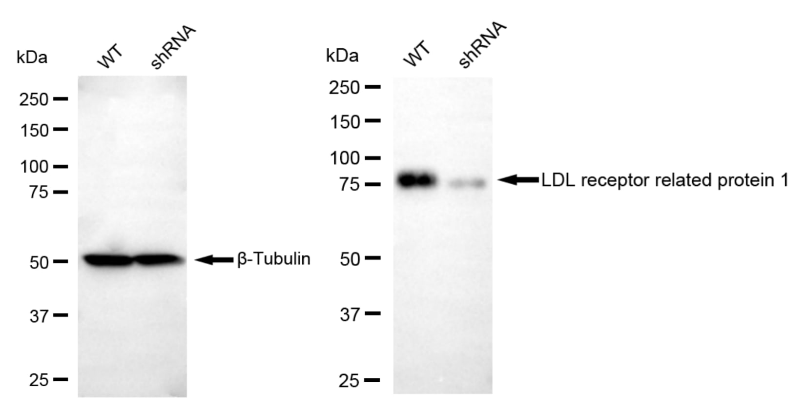 LRP-1 Antibody (24GB4945)